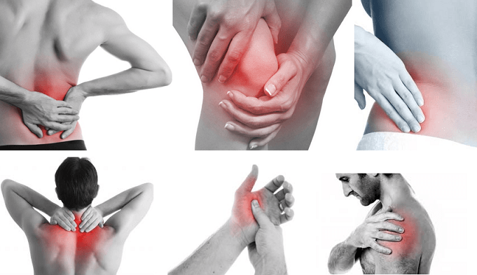 Pain Management Strategies for Arthritis Sufferers