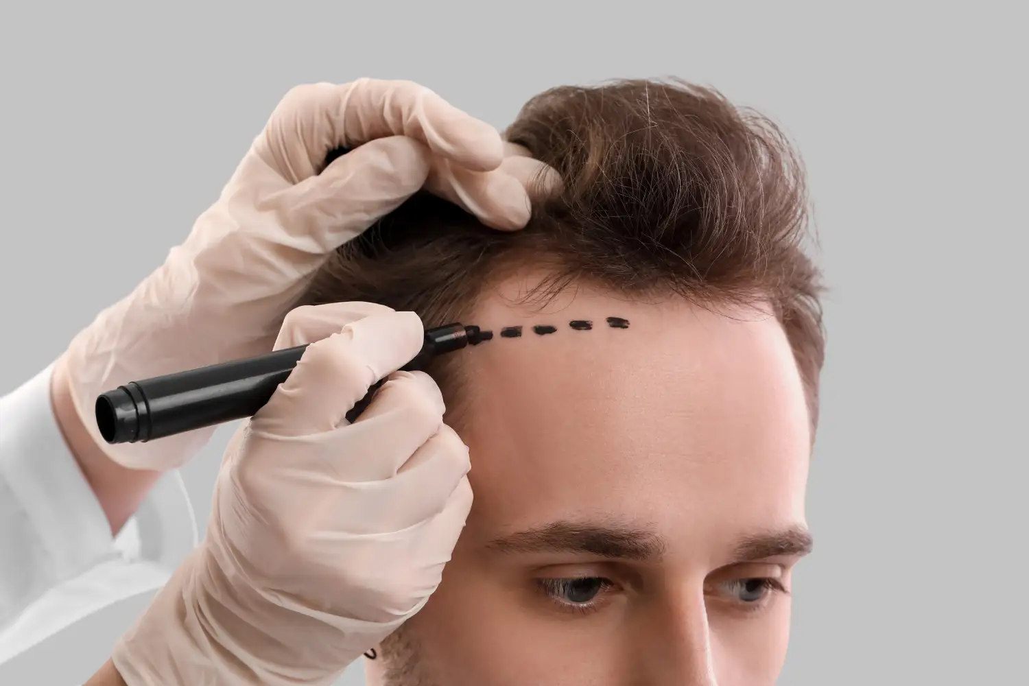 Hair Specialists in Islamabad