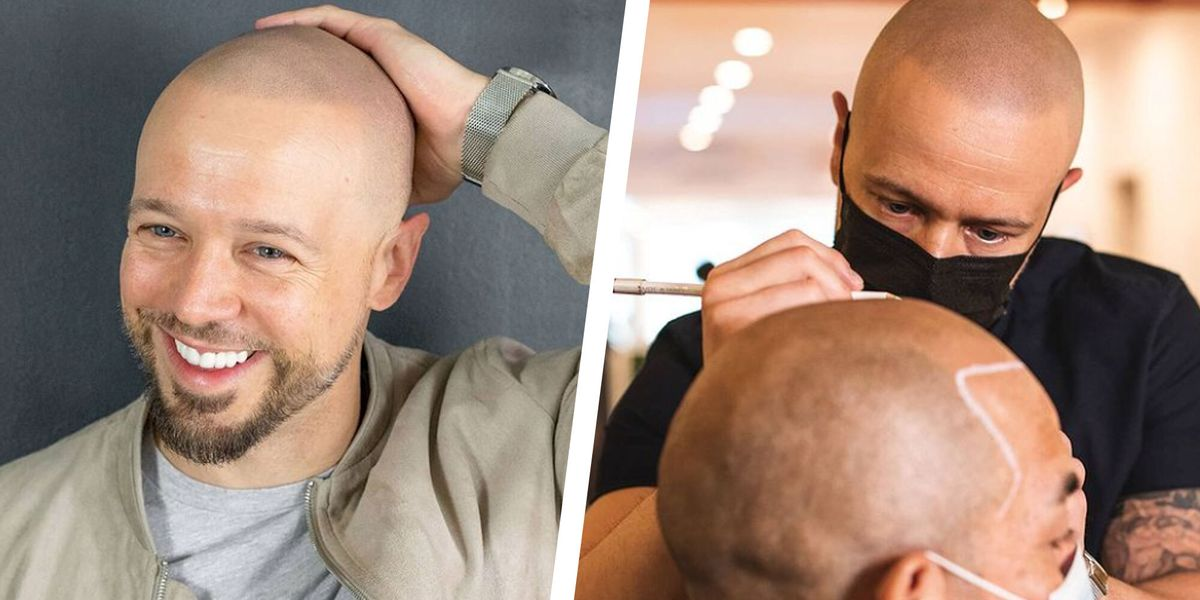 Scalp Micropigmentation Price Abu Dhabi