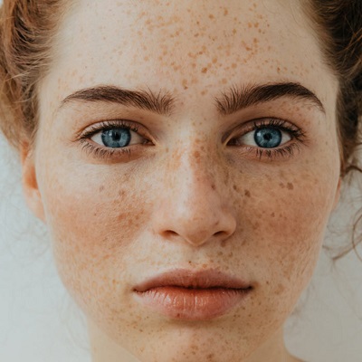 The Best Pigmentation Treatments for Different Skin Types