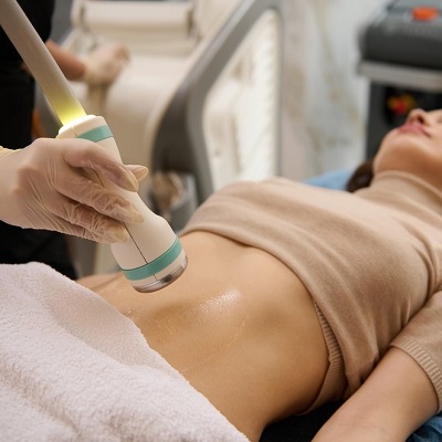 liposuction treatment (2)