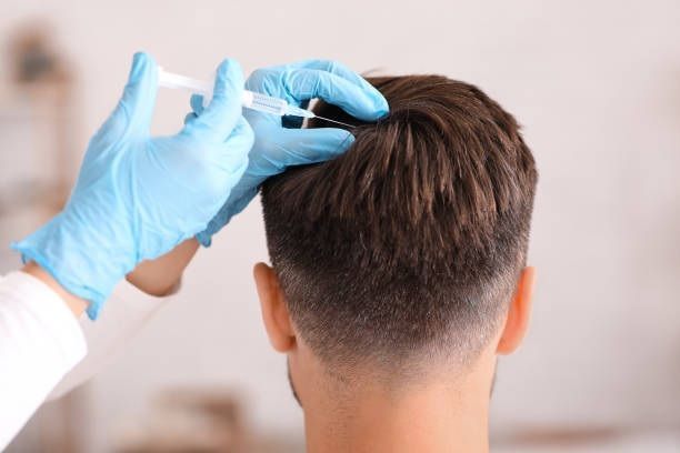 Hair transplant Treatment