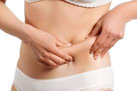 Tummy Tuck in Abu Dhabi