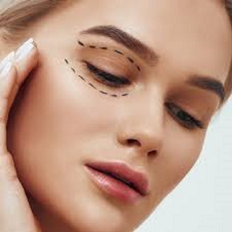 eyelid surgery in dubai